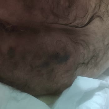 Florya Krankenhaus mangelnde Pflege und Hygiene in der Intensivstation