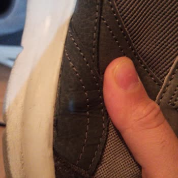 Hepsiburada Skechers Ayakkabı 1 Ayda Kenarlar Açıldı