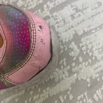 Skechers Garanti Kapsamındaki Ayakkabısının Arkasında Durmaması