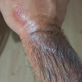 Duru Sıvı Sabun Mağduriyeti