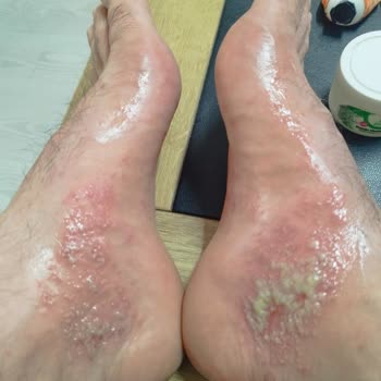 Abdi İbrahim Coldaway C Yan Etikleri Korkunç