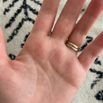 Starbucks'ta Dezenfektandan Kaynaklanan Kimyasal Yanık