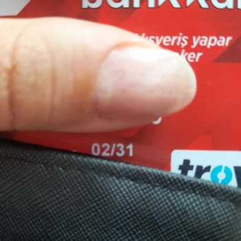Ziraat Bankası Bankamatiği Kartımı Kullandırmıyor