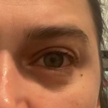 Loreal Paris Panorama Maskara Alerji Yaptı