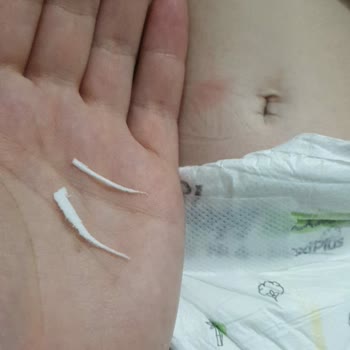 Sleepy Bezden Sivri Parça Çıktı