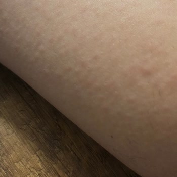 BİM Epi Sir Ağda Bandı 41 Li Set Şikayetim