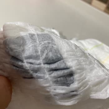 Baby Turco Bebek Bezi Şikayeti