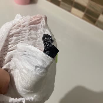 Baby Turco Bebek Bezi Şikayeti