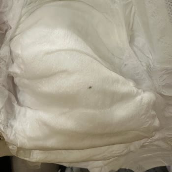 Sleepy Bebek Bezinden Siyah Şeyler Çıkması