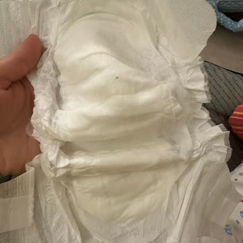 Sleepy Bebek Bezinden Siyah Şeyler Çıkması