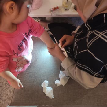 Pine Beach Belek Masaların Üstündeki Kaktüs Çocuklara Zarar Veriyor!