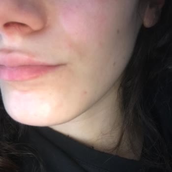 Rossmann Isana Hyaluron Intense Sorunu