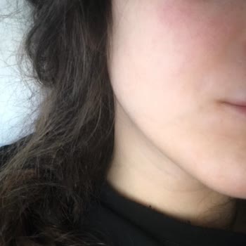 Rossmann Isana Hyaluron Intense Sorunu