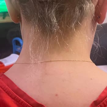 Rıza Demir Bayan Kuaför Saç Bakımı Sonrası Yaşanan Talihsiz Deneyim