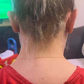 Rıza Demir Bayan Kuaför Saç Bakımı Sonrası Yaşanan Talihsiz Deneyim