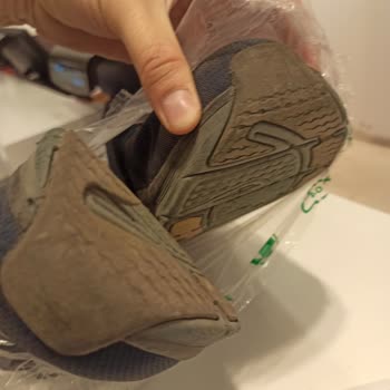 Skechers Müşteri Önemsemiyor 4 Aylık Ayakkabı Parçalandı