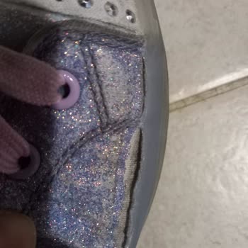 Skechers Pişmanlıktır! Aldığım Ayakkabı Paramparça Oldu!