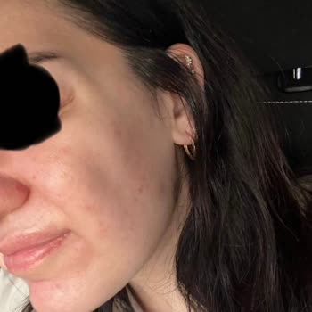 Op. Dr. Ekrem Keskin Yüzümün Şeklini Bozdu