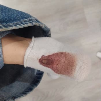 Adidas Samba Yara Yapması