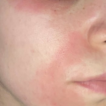 Garnier Micellar Çift Fazlı Makyaj Temizleme Suyu