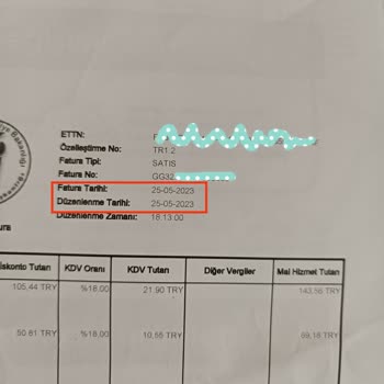 HP Gaming Notebook Ekranında Ölü Piksel Çıktı Kendiliğinden