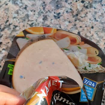 Namet Hindi Fümeden Yabancı Cisim Çıktı