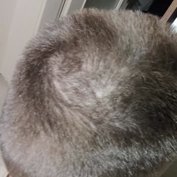 Bioblas Bir Ayda Saçlarımı Döktü