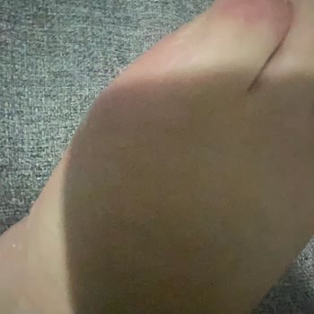 Converse Ayakkabı Ayağımı Mahvetti