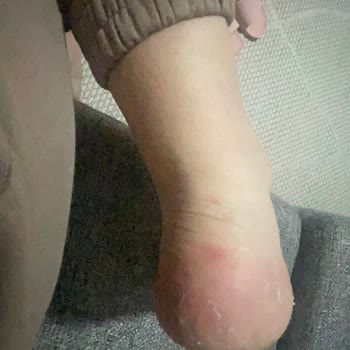 Converse Ayakkabı Ayağımı Mahvetti