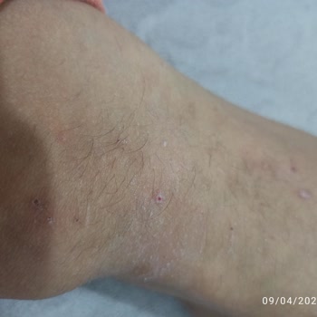 Dr. Aris Paranızı Boşa Harcamayın!.