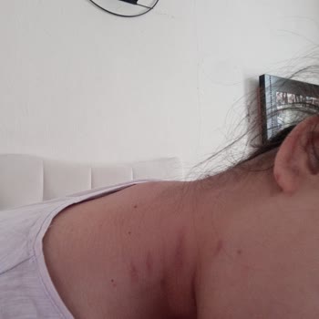 Mersin Şehir Hastanesi Görevlerini Düzgün Yapmayan Hasta Kayıt Ve Doktor