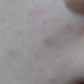 La Roche-Posay Солнцезащитный крем  Anthelios Uvmune 400 Невидимый Флюид испортил Моё Лицо!