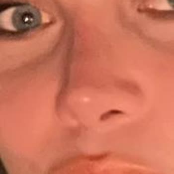 Prof. Dr. Murat Sarı 3 Kez Ameliyat Oldum