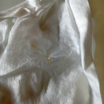 Başgimpa Ekmeğinden Tırnak Çıktı Nasıl Bir Re Za Let