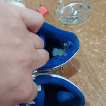 adidas Ayakkabının Aşırı Yıpranması