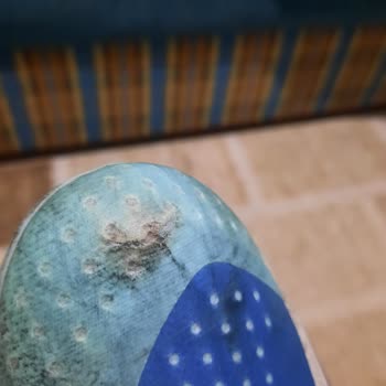 Yırtılan Adidas Kramponumun Garantisinin Karşılamaması