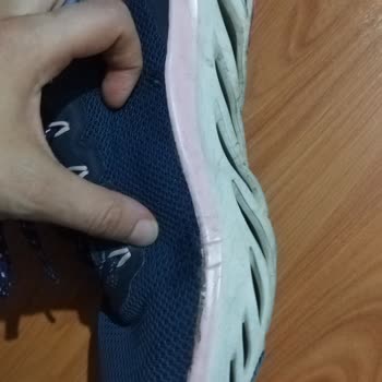 Skechers Markasının Artan Kalitesizliği Ve Fiyatı