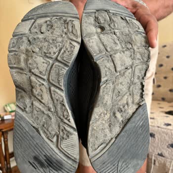 Skechers Taban Yarılma Problemi