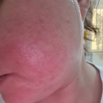 Neutrogena Yoğun Bakım Kremi