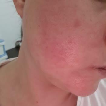 Neutrogena Yoğun Bakım Kremi