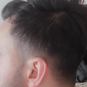 Urban Care Saçlarım Beyazlamaya Başladı