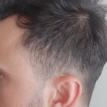 Urban Care Saçlarım Beyazlamaya Başladı