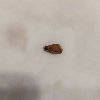 Burger King Dismissed the Mystery Object Without Investigation - Customer Service Fail!