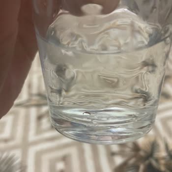 Kayseri Büyükşehir Belediyesi Musluk Suyunun İçinden Böcek Çıktı