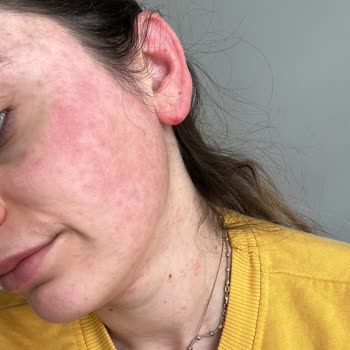 Doa Kozmetik Hyaluronik Asit + B3 Vitamini Serumu