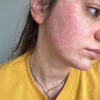 Doa Kozmetik Hyaluronik Asit + B3 Vitamini Serumu