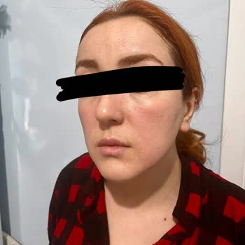 Neutrogena Zerdeçallı Yüz Temizleme Köpüğü Asla Alma!