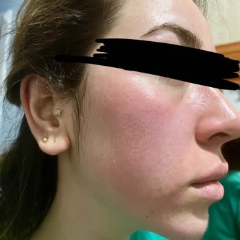 Neutrogena Zerdeçallı Yüz Temizleme Köpüğü Asla Alma!