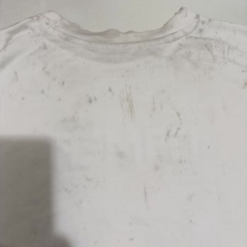 Dalin Ayrıca Saçta Kaşıntı Yapıyor