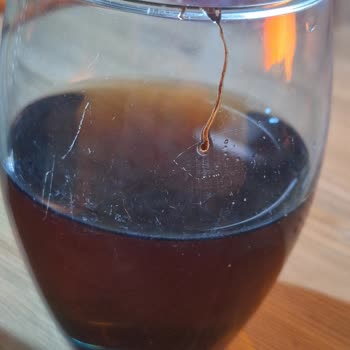 Çaykur Didi Yabancı Cisim Cıktı